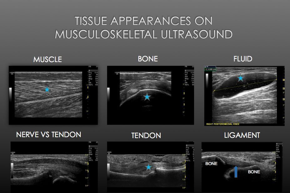 Musculoskeletal Ultrasound Course